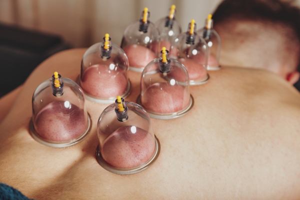 Wet cupping + massage